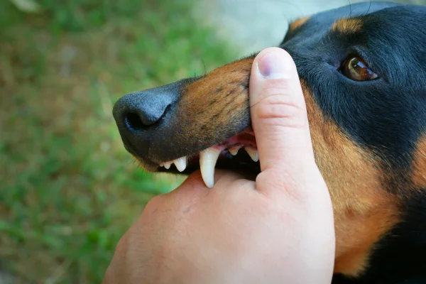 Meu cachorro me mordeu e a agora?