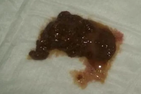 Dog faeces with goo