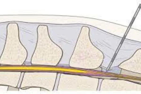 Anestesia Epidural em Cães (1)