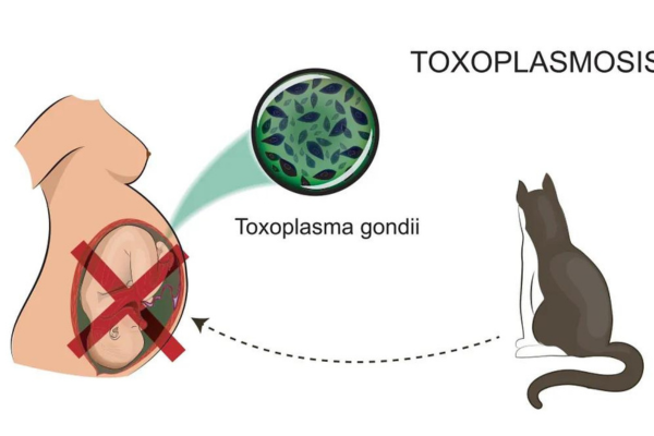 Toxoplasmose e Gravidez