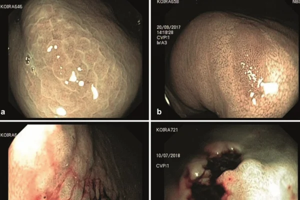 Stomach Cancer in Dogs 