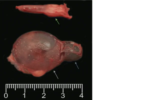 Cáncer de tiroides en perros